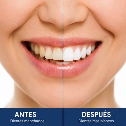 Dientes Blancos en 30 Minutos $RD 2,990 — Sin Pagar RD$12,000 en el Dentista