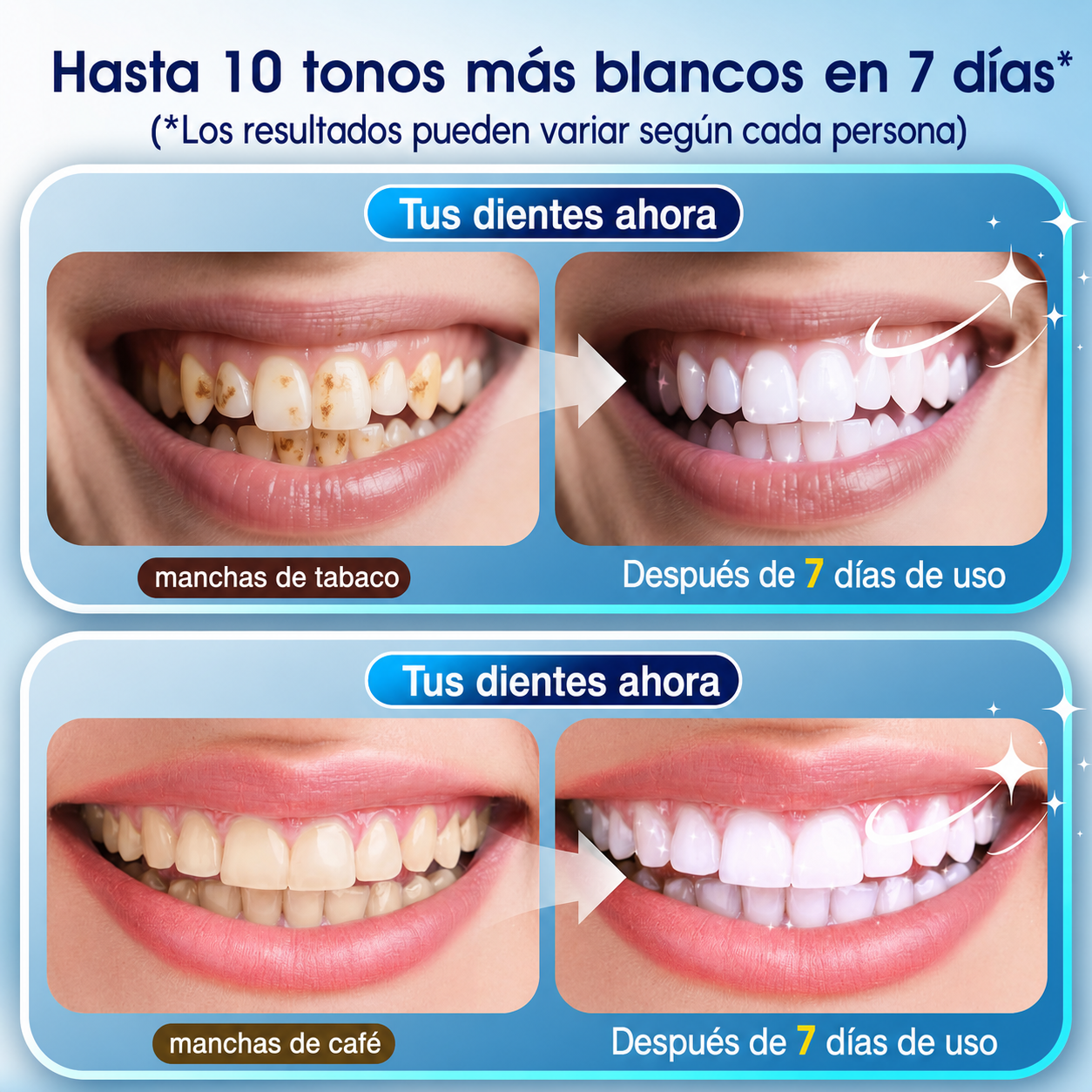Dientes Blancos en 30 Minutos $RD 2,990 — Sin Pagar RD$12,000 en el Dentista